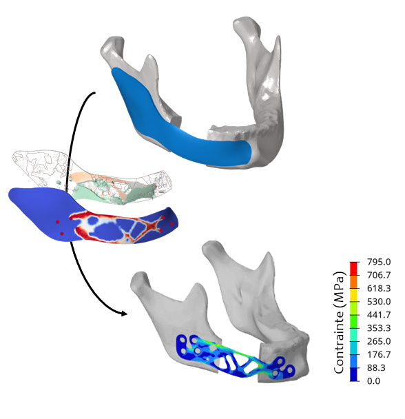 Glad 3D - Optimisation plaque de reconstruction